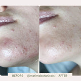 Glow Getter Blemish-Free Hydration Serum | All-in-One Serum + Moisturizer