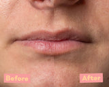 Lip Peeling AHA 5% & Marine BHA – Gentle Exfoliating Lip Treatment