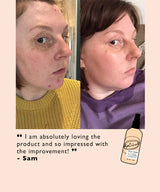 Hydrating Chamomile Face Toner with Hyaluronic Acid | Vegan & Clean Skincare