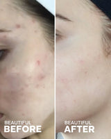 Hydrating Glow Serum with Tremella Mushroom & Vitamin C | Lightweight Jelly Serum