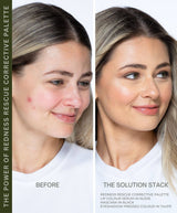 Redness & Discoloration Rescue Corrective Palette